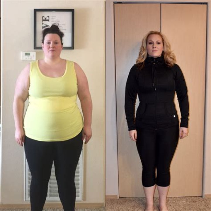 Before And After Weight Loss